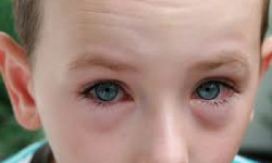 Professional team of six standing in front of Horvath Vision Care sign.